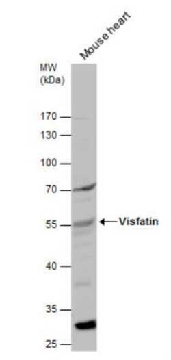 anti-PBEF/Visfatin/NAMPT, Polyclonal, Novus Biologicals 0.1 mL | Buy Online | Novus Biologicals | Fisher Scientific