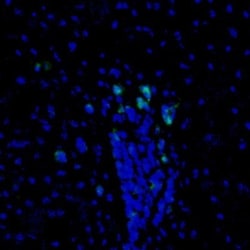 PBK Antibody, Novus Biologicals 25 &mu;L | Buy Online | Novus Biologicals | Fisher Scientific
