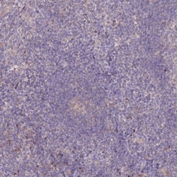 PBLD Antibody, Novus Biologicals:Antibodies:Primary Antibodies