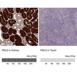 PBLD Antibody, Novus Biologicals:Antibodies:Primary Antibodies