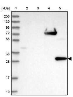 PBLD Antibody, Novus Biologicals:Antibodies:Primary Antibodies