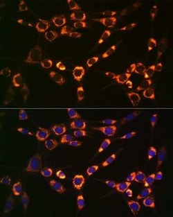 PBR Rabbit anti-Human, Mouse, Clone: 4I9K6, Novus Biologicals:Antibodies:Primary