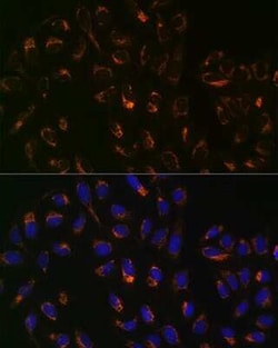 PBR Rabbit anti-Human, Mouse, Clone: 4I9K6, Novus Biologicals:Antibodies:Primary