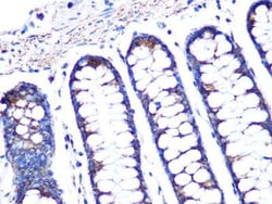 PBR Rabbit anti-Human, Mouse, Clone: 4I9K6, Novus Biologicals:Antibodies:Primary