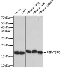 PBR Rabbit anti-Human, Mouse, Clone: 4I9K6, Novus Biologicals:Antibodies:Primary