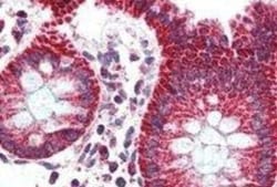 PBR Antibody, Novus Biologicals 0.1mg; Unlabeled:Antibodies