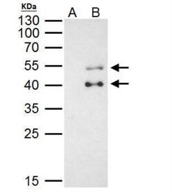 PBX1 Antibody, Novus Biologicals 0.1mL; Unlabeled:Antibodies, Polyclonal
