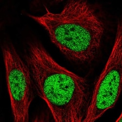 PBX2 Antibody, Novus Biologicals 0.1mL; Unlabeled:Antibodies, Polyclonal