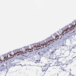 PBX2 Antibody, Novus Biologicals 0.1mL; Unlabeled:Antibodies, Polyclonal