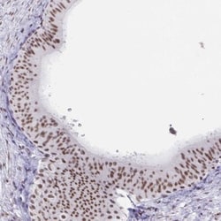 PBX2 Antibody, Novus Biologicals 0.1mL; Unlabeled:Antibodies, Polyclonal