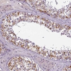 PBX4 Antibody, Novus Biologicals:Antibodies:Primary Antibodies