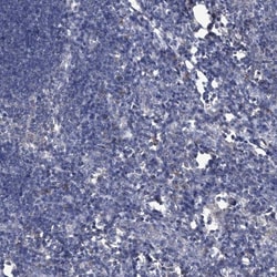 PC6 Antibody, Novus Biologicals 25 &mu;L; Unlabeled:Antibodies, Polyclonal