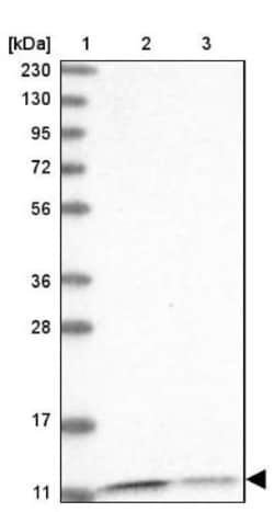 PCBD1 Antibody, Novus Biologicals 0.1mL; Unlabeled:Antibodies, Polyclonal