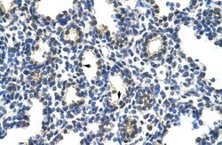 PCBP2 Antibody, Novus Biologicals 100 ul; Unconjugated:Antibodies, Polyclonal
