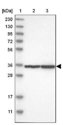 PCBP3 Antibody, Novus Biologicals:Antibodies:Primary Antibodies