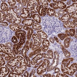 PCCA Antibody, Novus Biologicals 0.1mL; Unlabeled:Antibodies, Polyclonal