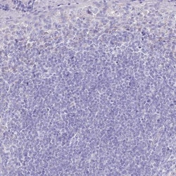 PCCA Antibody, Novus Biologicals 0.1mL; Unlabeled:Antibodies, Polyclonal