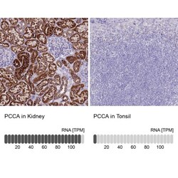PCCA Antibody, Novus Biologicals 0.1mL; Unlabeled:Antibodies, Polyclonal