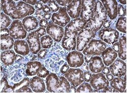 PCCB Antibody, Novus Biologicals 0.1mL; Unlabeled:Antibodies, Polyclonal