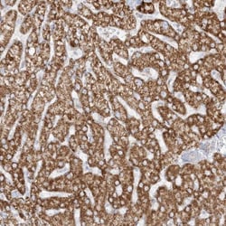 PCCB Antibody, Novus Biologicals 25 &mu;L; Unlabeled:Antibodies, Polyclonal