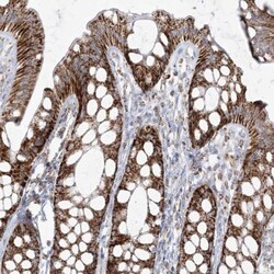 PCCB Antibody, Novus Biologicals 25 &mu;L; Unlabeled:Antibodies, Polyclonal