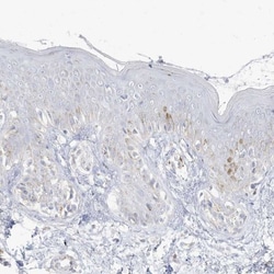 PCCB Antibody, Novus Biologicals 25 &mu;L; Unlabeled:Antibodies, Polyclonal
