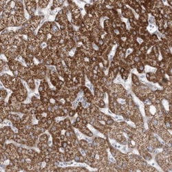 PCCB Antibody, Novus Biologicals 0.1 mL | Buy Online | Novus Biologicals | Fisher Scientific