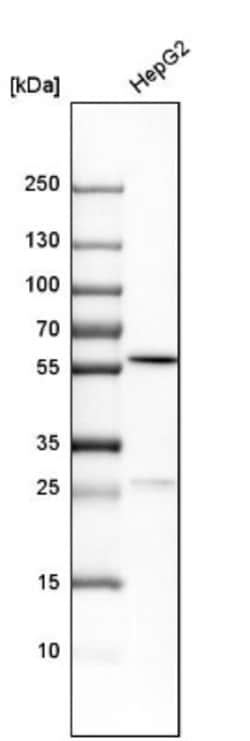 PCCB Antibody, Novus Biologicals 25 &mu;L; Unlabeled:Antibodies, Polyclonal