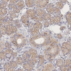 PCDH11 Antibody, Novus Biologicals 25 &mu;L; Unlabeled:Antibodies, Polyclonal