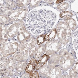 PCDHB6 Antibody, Novus Biologicals 0.1mL; Unlabeled:Antibodies, Polyclonal