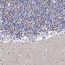 PCDHGA10 Rabbit anti-Human, Polyclonal, Novus Biologicals 100 &mu;g | Buy Online | Novus Biologicals | Fisher Scientific