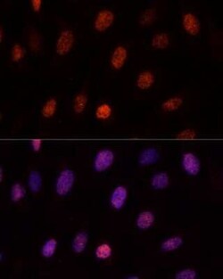 PCGF1 Rabbit anti-Human, Mouse, Rat, Polyclonal, Novus Biologicals 100 &mu;g | Buy Online | Novus Biologicals | Fisher Scientific