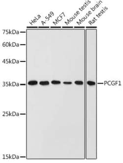 PCGF1 Rabbit anti-Human, Mouse, Rat, Polyclonal, Novus Biologicals 100 &mu;g | Buy Online | Novus Biologicals | Fisher Scientific