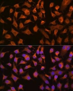 PCK2 Rabbit anti-Human, Mouse, Rat, Clone: 10L10J8, Novus Biologicals 20 &mu;g | Buy Online | Novus Biologicals | Fisher Scientific