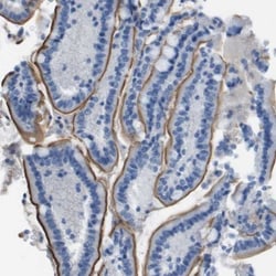 PCLKC Antibody, Novus Biologicals 0.1mL; Unlabeled:Antibodies, Polyclonal