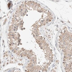 PCM1 Antibody, Novus Biologicals 25 &mu;L; Unlabeled:Antibodies, Polyclonal