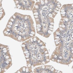 PCM1 Antibody, Novus Biologicals 25 &mu;L; Unlabeled:Antibodies, Polyclonal