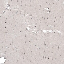 PCM1 Antibody, Novus Biologicals 25 &mu;L; Unlabeled:Antibodies, Polyclonal