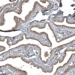 PCM1 Antibody, Novus Biologicals 25 &mu;L; Unlabeled:Antibodies, Polyclonal