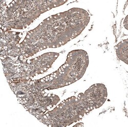 PCM1 Antibody, Novus Biologicals 25 &mu;L; Unlabeled:Antibodies, Polyclonal