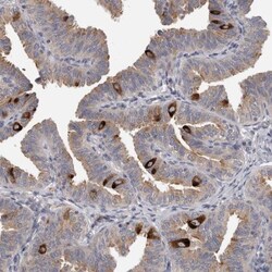 PCM1 Antibody, Novus Biologicals 0.1mL; Unlabeled:Antibodies, Polyclonal