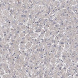 PCM1 Antibody, Novus Biologicals 0.1mL; Unlabeled:Antibodies, Polyclonal