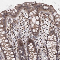 PCM1 Antibody, Novus Biologicals 0.1mL; Unlabeled:Antibodies, Polyclonal