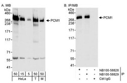 PCM1 Antibody, Novus Biologicals 0.1mL; Unlabeled:Antibodies, Polyclonal