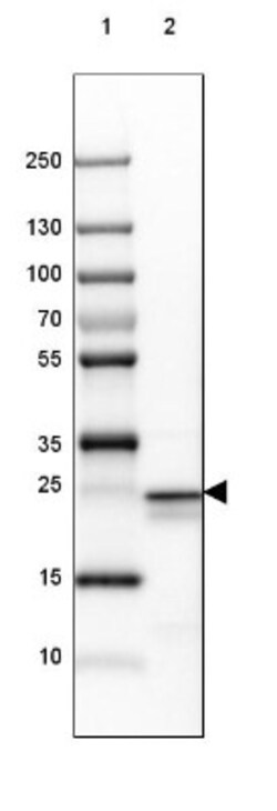 PCMT1 Antibody, Novus Biologicals 0.1mL; Unlabeled:Antibodies, Polyclonal