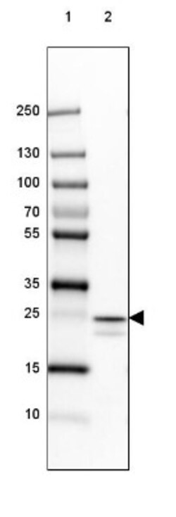 PCMT1 Antibody, Novus Biologicals 0.1mL; Unlabeled:Antibodies, Polyclonal