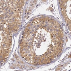 PCTAIRE1 Antibody, Novus Biologicals 0.1mL; Unlabeled:Antibodies, Polyclonal