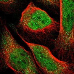 PCTAIRE2 Antibody, Novus Biologicals 0.1mL; Unlabeled:Antibodies, Polyclonal