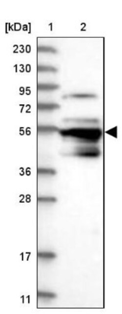 PCYOX1L Antibody, Novus Biologicals 0.1mL; Unlabeled:Antibodies, Polyclonal