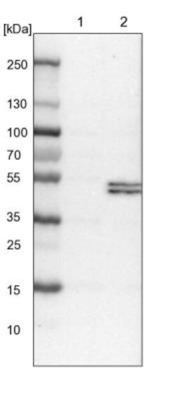 PCYT2 Antibody, Novus Biologicals 0.1 mL | Buy Online | Novus Biologicals | Fisher Scientific